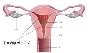 子宮 口 カメラ オファー